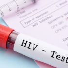 Информация об эпидемиологической ситуации по ВИЧ-инфекции