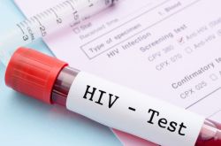 Информация об эпидемиологической ситуации по ВИЧ-инфекции